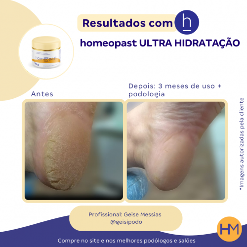 Ultra Hidratação